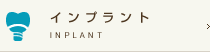 インプラント